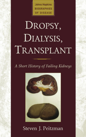 Cover image of Dropsy, Dialysis, Transplant