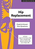 Cover image of Hip Replacement